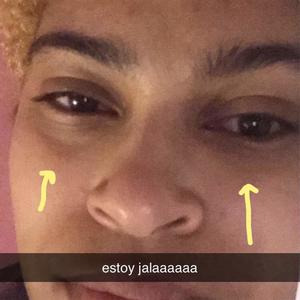 dancing the pain away