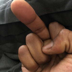 Many Motion (Explicit)