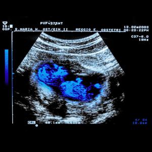 Il canto (Intro) (feat. Em.manuel)