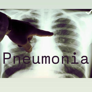 Pneumonia (Explicit)