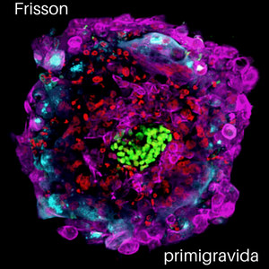 Vision(Freestlye) (Explicit)