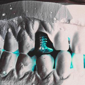 DIMANTU SKRŪVES (Explicit)