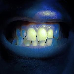 APPLYY THE PRESSURE (Explicit)