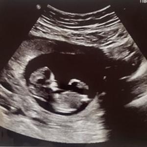 About To Be A Dad (feat. ExFold) (Explicit)