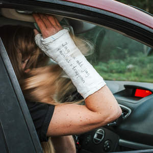 Jag sa att jag ramlat i trappan