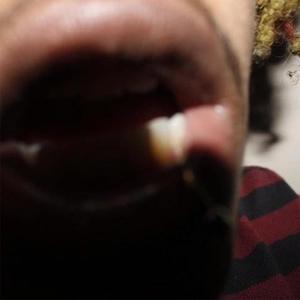 radrr (feat. g0r3c0r3)