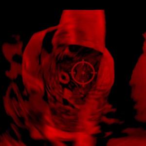 bdk (feat. imsomarcus, yotti & Rekover Jet) (Explicit)