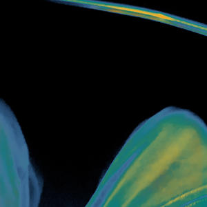 TRANSATLANTIC (Explicit)