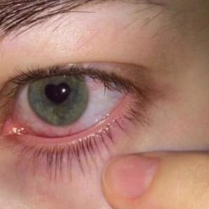 Secrets+, Pt. 2(feat. Moose) (Explicit)