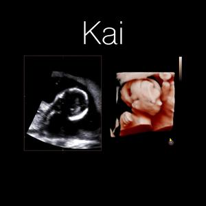 Kai