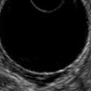 Soiled - Pulsating to the Wrong Conclusion