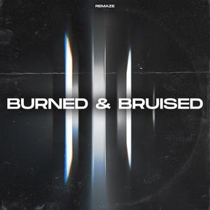 Burned & Bruised