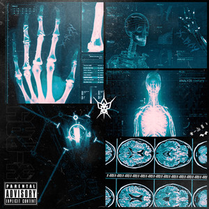 X-RAY (Explicit)