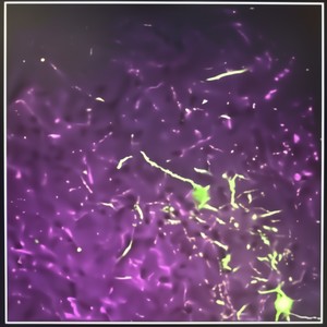 RUN(feat. ****WRENCH, MOOUNIE, Boy Unknown & NorriLuvsU) (Explicit)