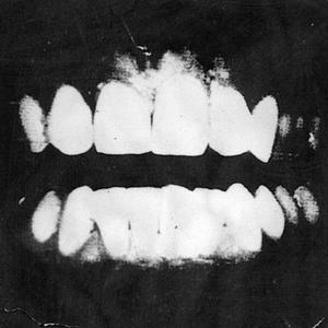 ALL DAY (Sped Up) (Explicit)