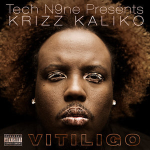 Vitiligo (Explicit)