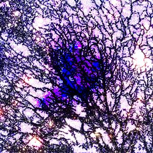 suffocation of ranking dread