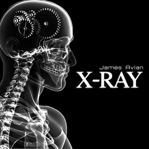 X-Ray