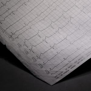 Latidos Rapidos (feat. Peregrino JL, Marche+ & Angel Del Rap) (Explicit)