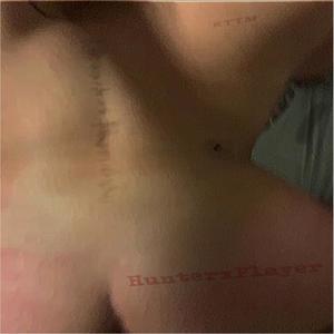 HunterxPlayer (Explicit)