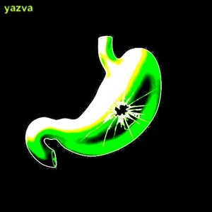 Yazva (Explicit)