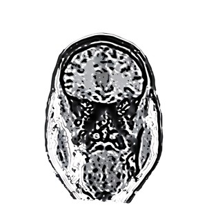 Sie sagen das (Explicit)