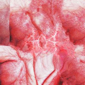 lostcause(feat. heylog)