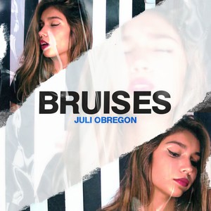 Bruises