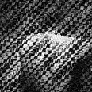 kurek kemikleri arasinda