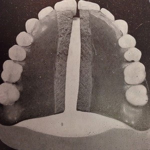 Geeses (Ishmael Remix)