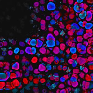 After Sheltering (feat. Raise)