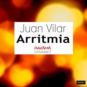 Arritmia