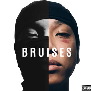 Melrose - Bruises (Explicit)