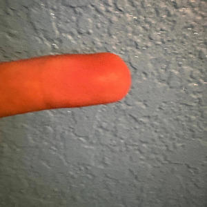 Loony Kunja (Remix|Explicit)