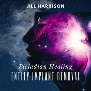 Pleiadian Healing Entity Implant Removal