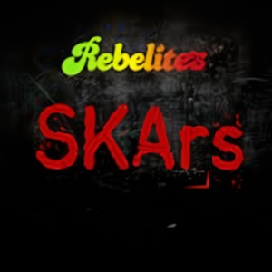 SKArs