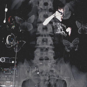 Motýle v bruchu ťa ľúbia, o tom nevedia