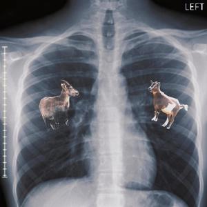 Bronchitis (Explicit)