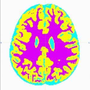 When Did I Stop Breathing?