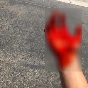 OuterZone (Explicit)