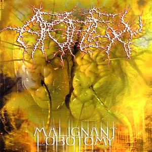 Malignant Lobotomy