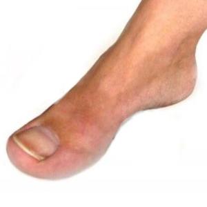 Ich kann quasi garnix (Explicit)