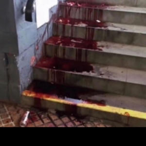 it hurts to see you like this