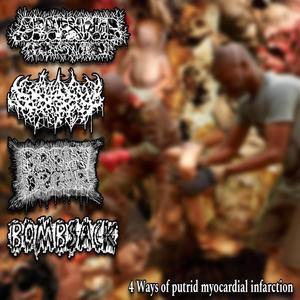 4 Ways Of Putrid Myocardial Infarction (4 way split w/ Arachnid Infestation/Spitsaw/Bombsack) Brain Decor Side [Explicit]