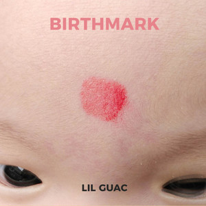 Birthmark