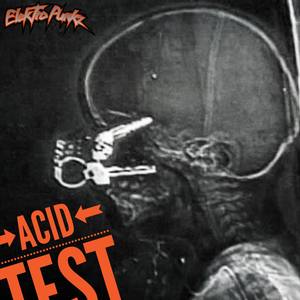 Acid Test 313 (Explicit)