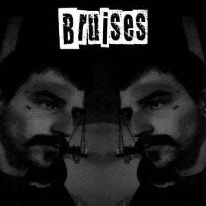 Bruises (Explicit)