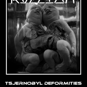 Tjernobyl deformities