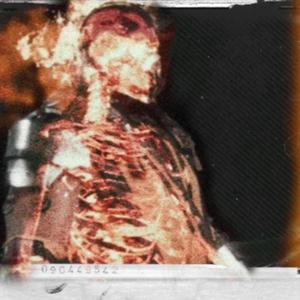 Burning