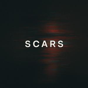 Scars